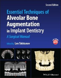 Essential Techniques of Alveolar Bone Augmentation in Implant Dentistry - 