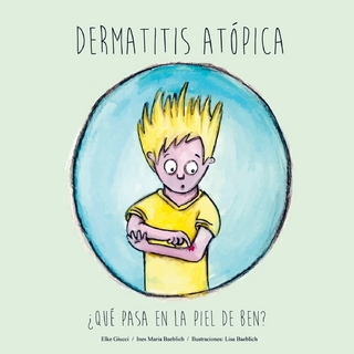 Dermatitis Atópica