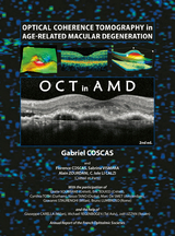 Optical Coherence Tomography in Age-Related Macular Degeneration - Gabriel Coscas