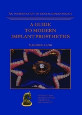 A guide to modern implant prosthetics - 