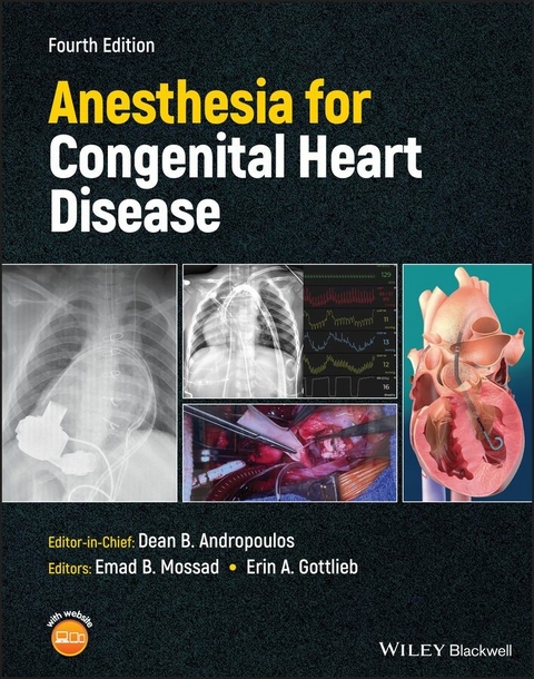 Anesthesia for Congenital Heart Disease - 