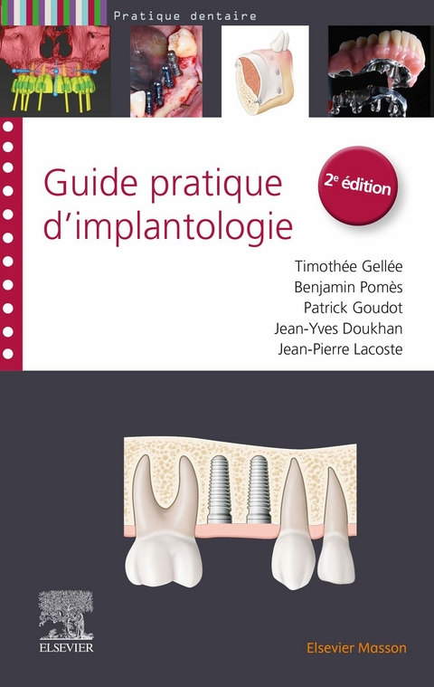 Guide pratique d'implantologie -  Timothee Gellee,  Patrick Goudot,  Jean-Pierre Lacoste,  Benjamin Pomes