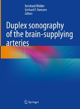 Duplex sonography of the brain-supplying arteries - 