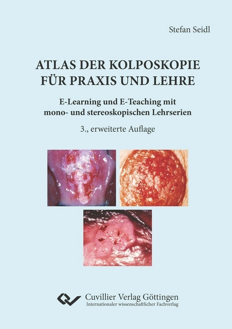 Atlas der Kolposkopie für Praxis und Lehre -  Stefan Seidl