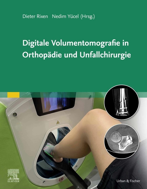 Digitale Volumentomografie in Orthopädie und Unfallchirurgie - 