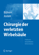 Chirurgie der verletzten Wirbels&auml;ule - 