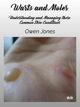 Warts And Moles -  Owen Jones