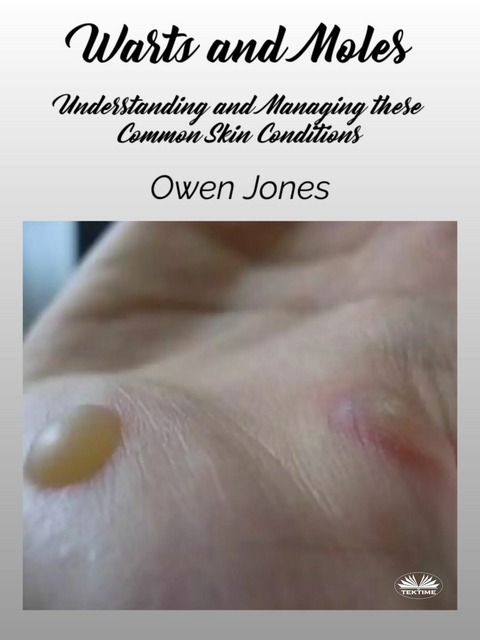 Warts And Moles -  Owen Jones