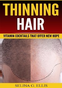 Thinning Hair - Selina G Ellis