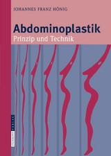 Abdominoplastik - Johannes-Franz H&ouml;nig