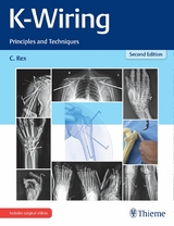 K-Wiring - Chandrabose Rex