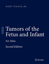 Tumors of the Fetus and Infant - Hart Isaacs