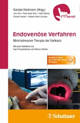 Endoven&ouml;se Verfahren -  Jens Alm,  Franz-Xaver Breu,  Uldis Maurins,  Felizitas Pannier,  Stefanie Reich-Schupke