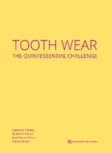 Tooth Wear - D&eacute;bora R. Vilaboa, Beatriz R. Vilaboa, Jose Manuel Reuss, D&eacute;bora Reuss