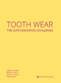 Tooth Wear - D&eacute;bora R. Vilaboa, Beatriz R. Vilaboa, Jose Manuel Reuss, D&eacute;bora Reuss