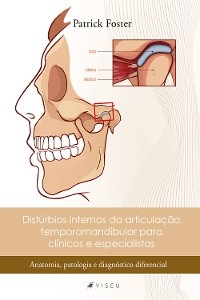 Distúrbios internos da articulação temporomandibular para clínicos e especialistas