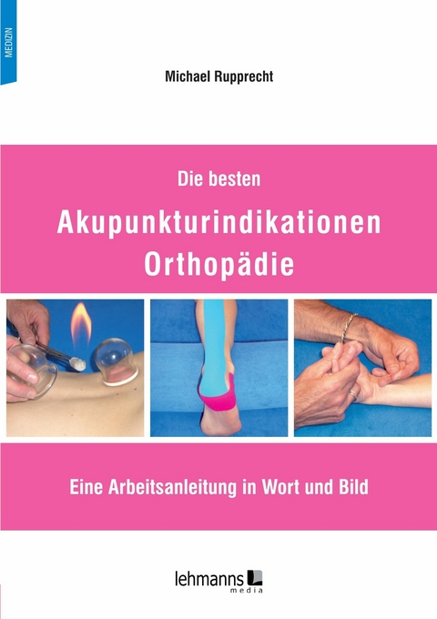 Die besten Akupunkturindikationen Orthop&auml;die - Michael Rupprecht