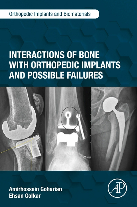 Interactions of Bone with Orthopedic Implants and Possible Failures -  Amirhossein Goharian,  Ehsan Golkar