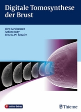 Digitale Tomosynthese der Brust - 