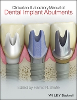 Clinical and Laboratory Manual of Dental Implant Abutments -  Hamid R. Shafie