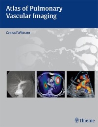 Atlas of Pulmonary Vascular Imaging - Conrad Wittram