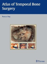 Atlas of Temporal Bone Surgery - Tuncay Ulug