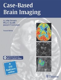 Case-Based Brain Imaging - A. John Tsiouris, Pina C. Sanelli, Joseph Comunale