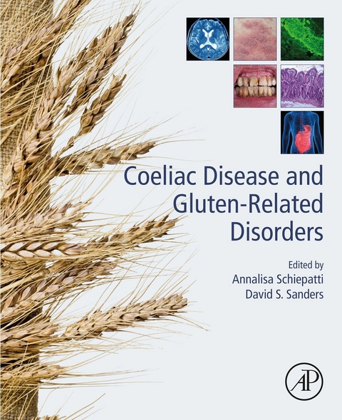 Coeliac Disease and Gluten-Related Disorders - 