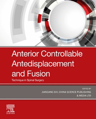 Anterior Controllable Antedisplacement and Fusion (ACAF)