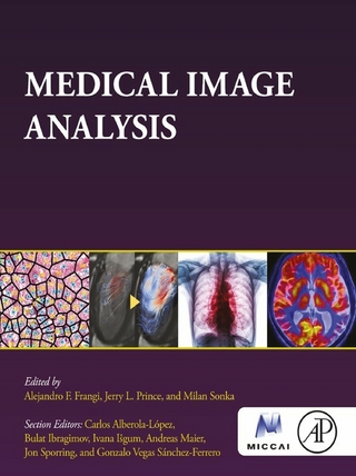 Medical Image Analysis