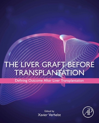 Liver Graft Before Transplantation