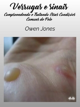 Verrugas E Sinais -  Owen Jones