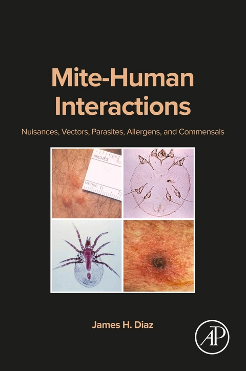 Mite-Human Interactions -  James H. Diaz
