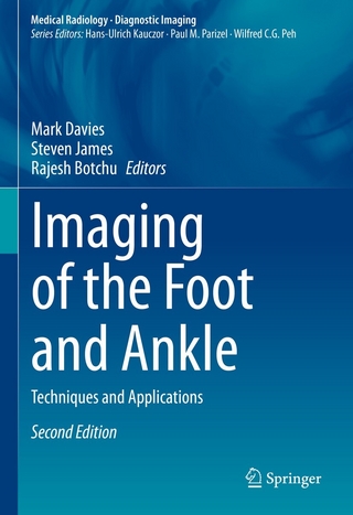 Imaging of the Foot and Ankle