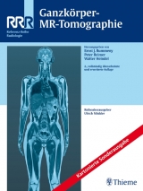 Ganzk&ouml;rper-MR-Tomographie - 