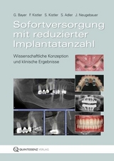 Sofortversorgung mit reduzierter Implantatanzahl - Frank Kistler, Georg Bayer, Steffen Kistler, Stephan Adler, J&ouml;rg Neugebauer, Fabian Sigmund, Freimut Vizethum, Michael Weiss