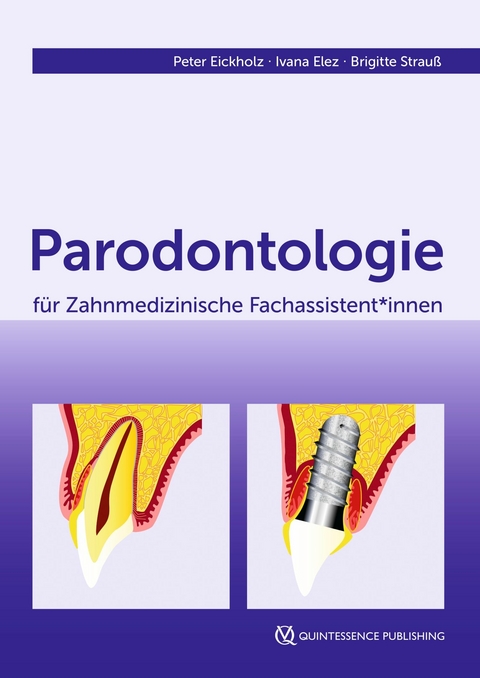 Parodontologie f&uuml;r Zahnmedizinische Fachassistent*innen - Peter Eickholz, Ivana Elez, Brigitte Strau&szlig;