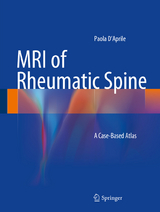 MRI of Rheumatic Spine - Paola D&rsquo;Aprile
