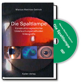Die Spaltlampe - Marcus-Matthias Gellrich
