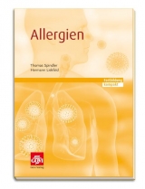 Allergien - Thomas Spindler, Hermann Liekfeld