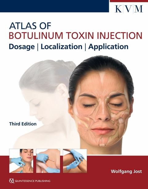 Atlas of Botulinum Toxin Injection - Wolfgang Jost