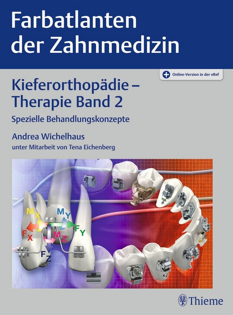 Kieferorthop&auml;die - Therapie Band 2 - 