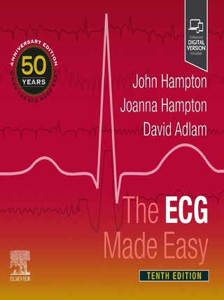 ECG Made Easy E-Book
