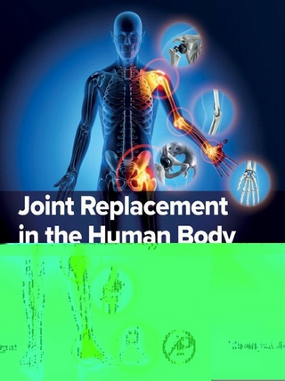 Joint Replacement in the Human Body