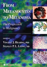 From Melanocytes to Melanoma - 