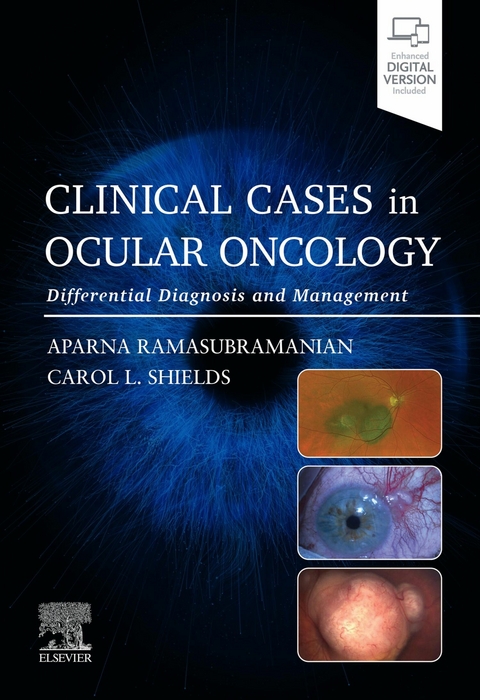 Clinical Cases in Ocular Oncology - E-BOOK - 