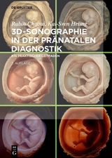 3D-Sonographie in der pr&auml;natalen Diagnostik - Rabih Chaoui, Kai-Sven Heling