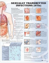 Sexually Transmitted Infections Anatomical Chart - 
