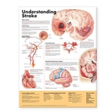 Understanding Stroke Anatomical Chart - 