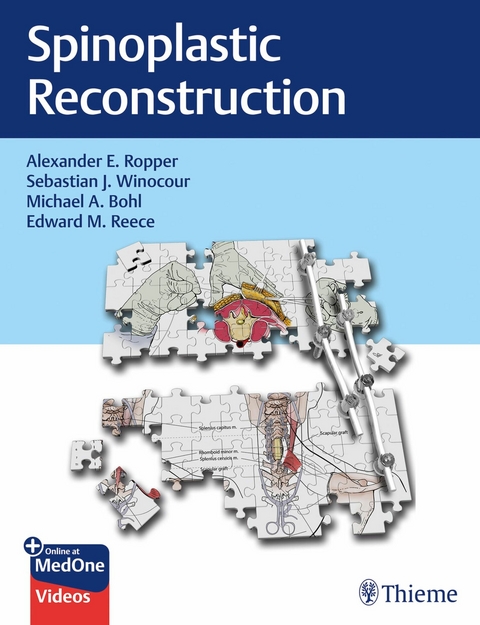 Spinoplastic Reconstruction -  Alexander Ropper,  Sebastian Winocour,  Michael Bohl,  Edward Reece